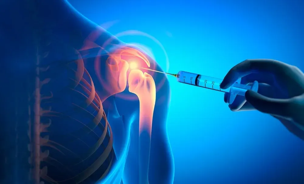 Why Choose Endura Health Direct for Joint Injections