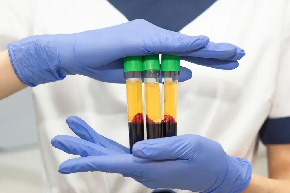 The Science Behind PRP Healing