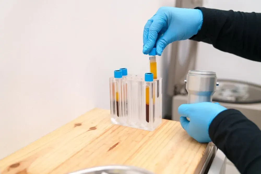 Ideal Candidates for PRP Therapy