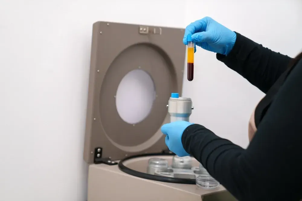 Your PRP Treatment Journey