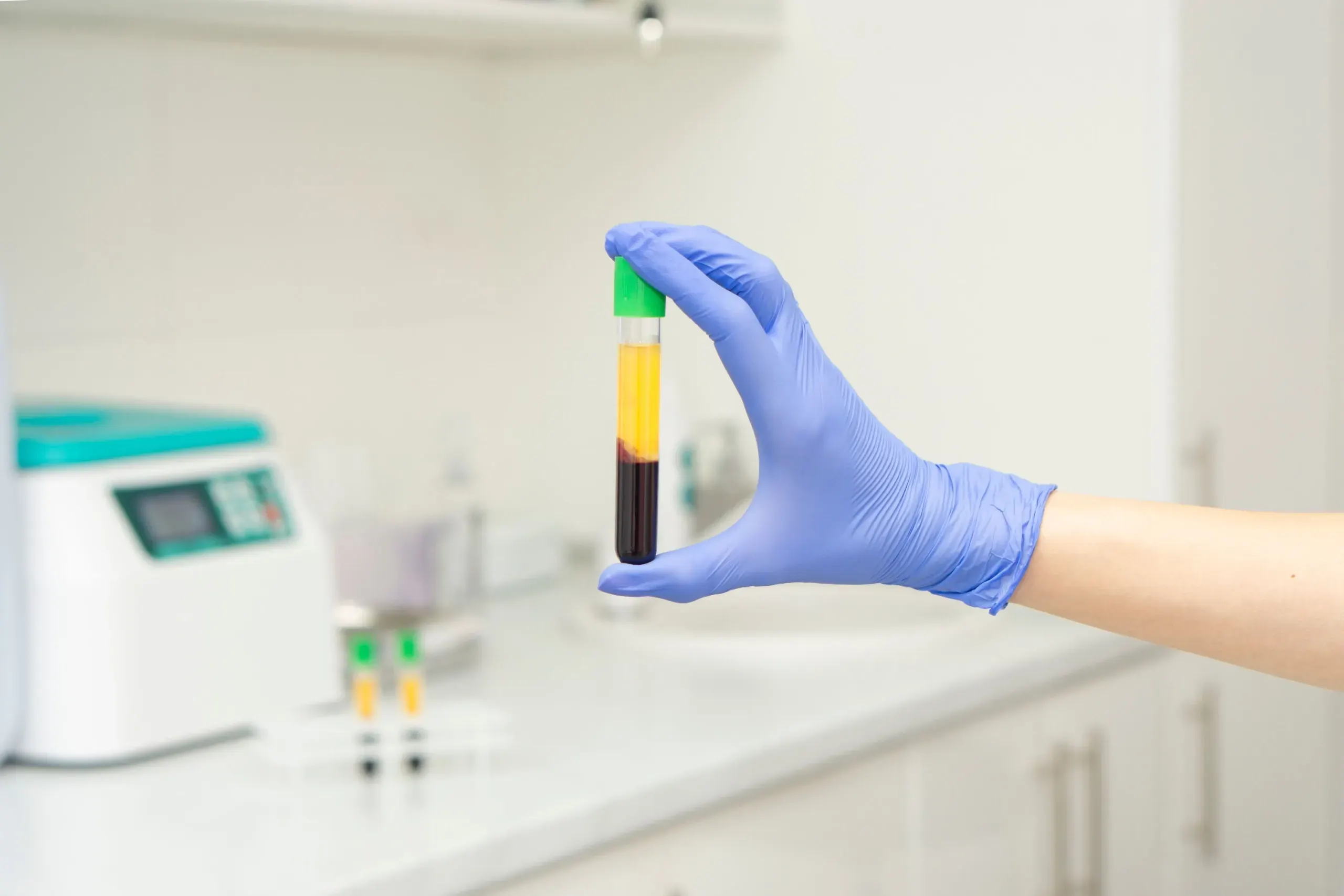 PRP Therapy for Muscle Injuries